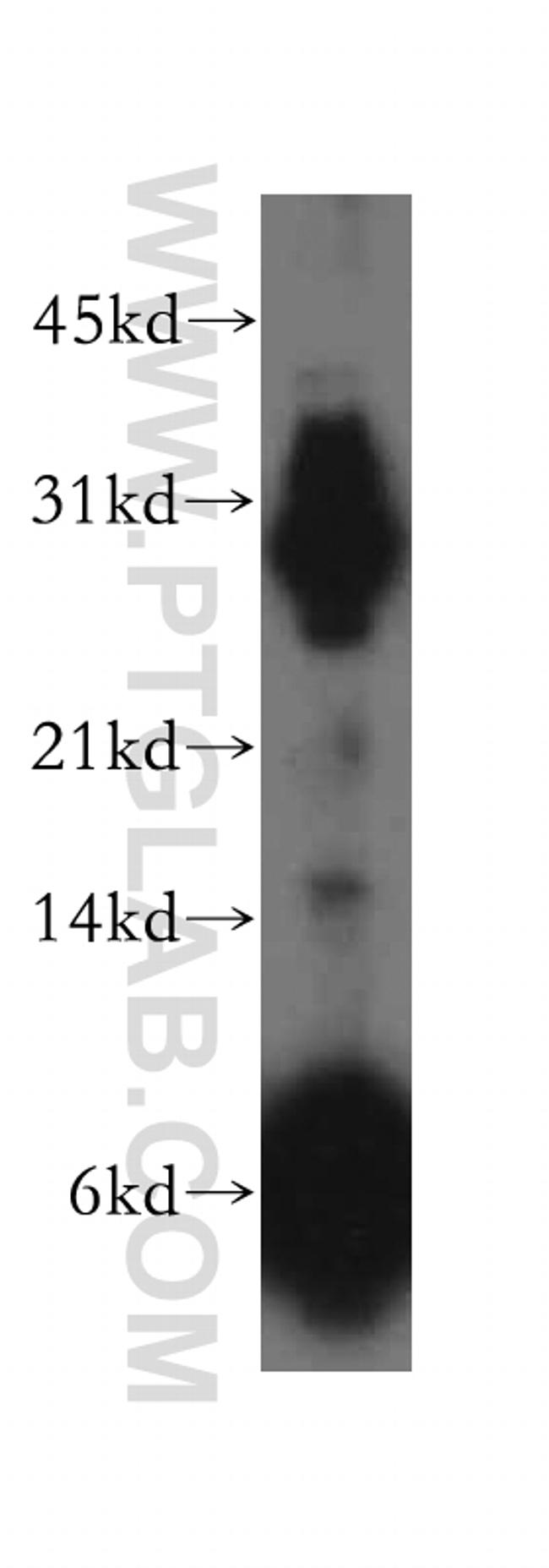 PSME2 Antibody in Western Blot (WB)