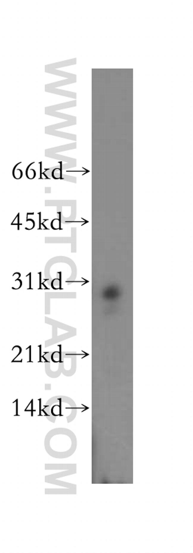 PSME2 Antibody in Western Blot (WB)