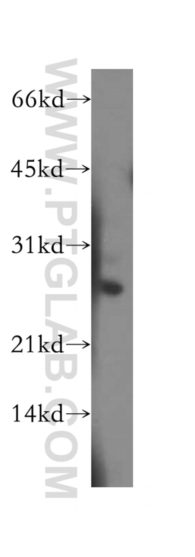 PSME2 Antibody in Western Blot (WB)