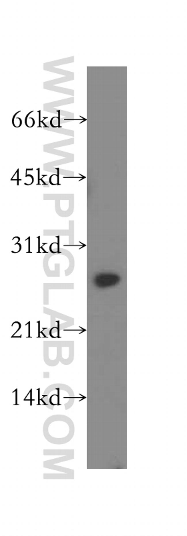 PSME2 Antibody in Western Blot (WB)