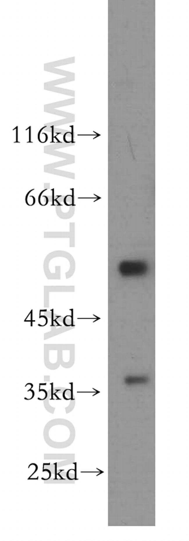 IFRD1 Antibody in Western Blot (WB)