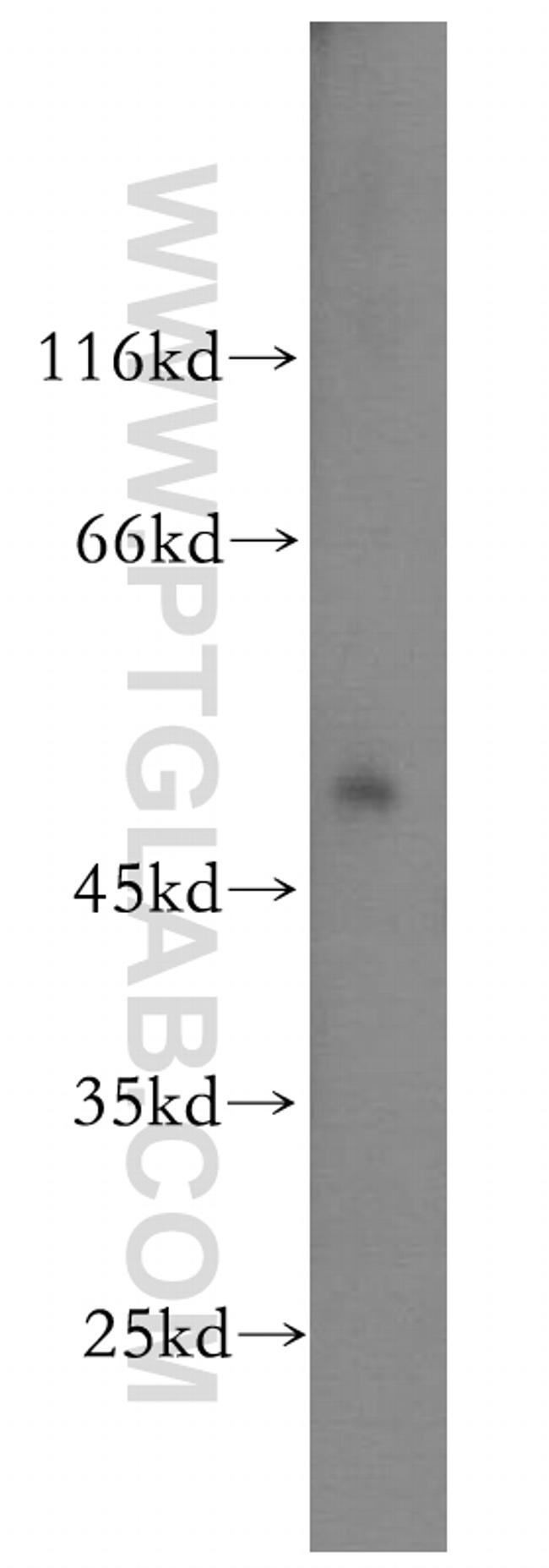 IFRD1 Antibody in Western Blot (WB)