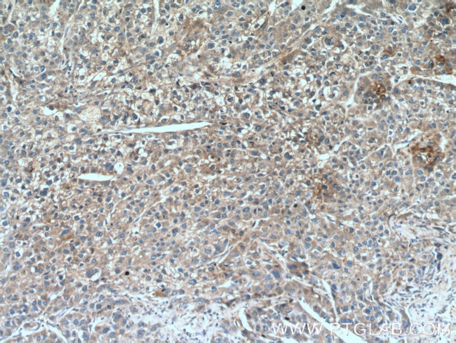 TSSK3 Antibody in Immunohistochemistry (Paraffin) (IHC (P))