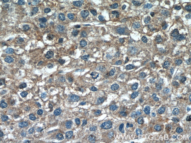 TSSK3 Antibody in Immunohistochemistry (Paraffin) (IHC (P))