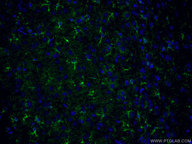 CLASP2 Antibody in Immunohistochemistry (PFA fixed) (IHC (PFA))