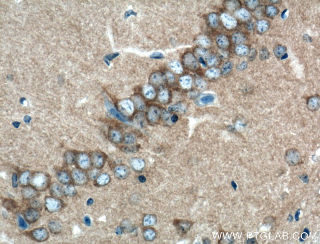 CLASP2 Antibody in Immunohistochemistry (Paraffin) (IHC (P))