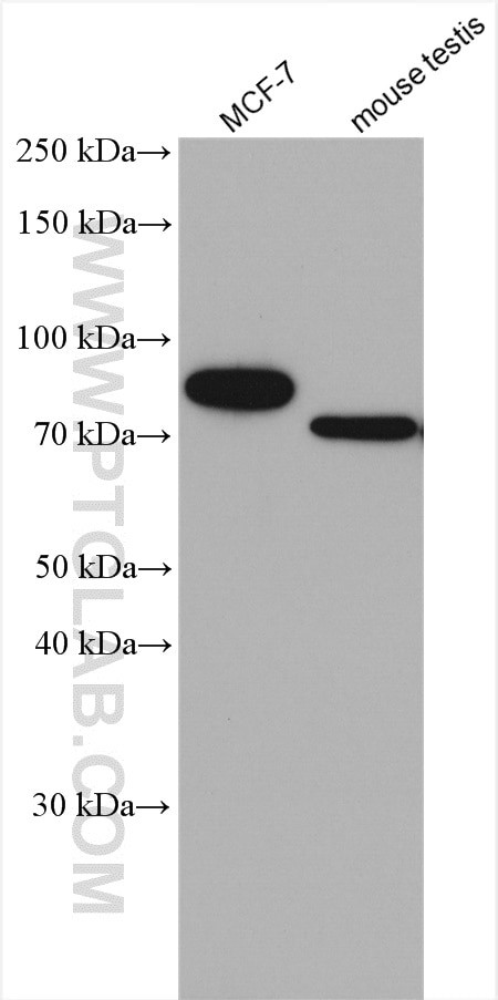 SLC27A3 Antibody in Western Blot (WB)