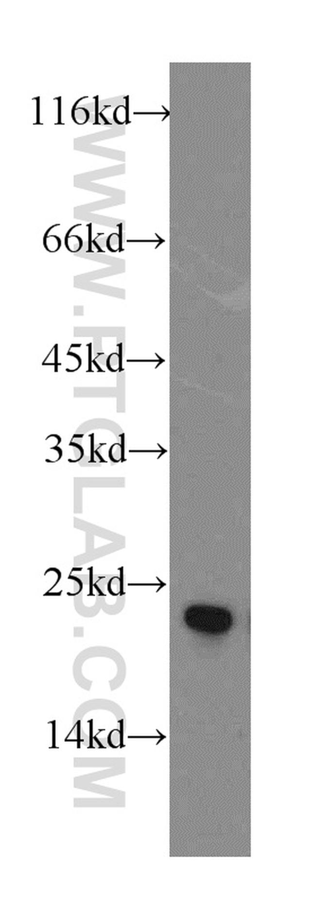 GCAP1 Antibody in Western Blot (WB)