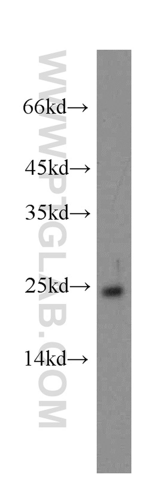 GCAP1 Antibody in Western Blot (WB)