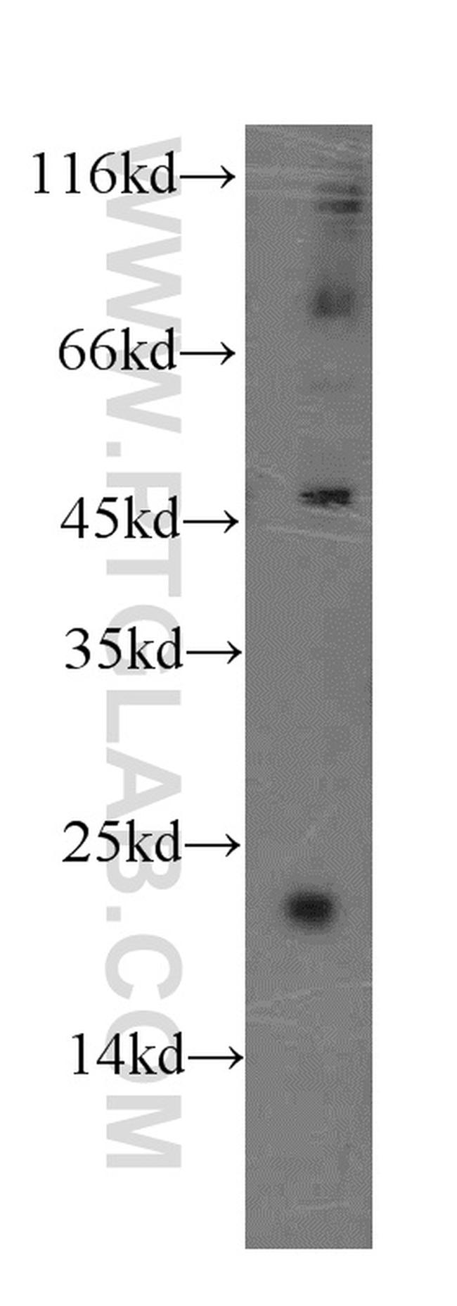 GCAP1 Antibody in Western Blot (WB)