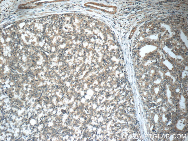 GAGE7 Antibody in Immunohistochemistry (Paraffin) (IHC (P))