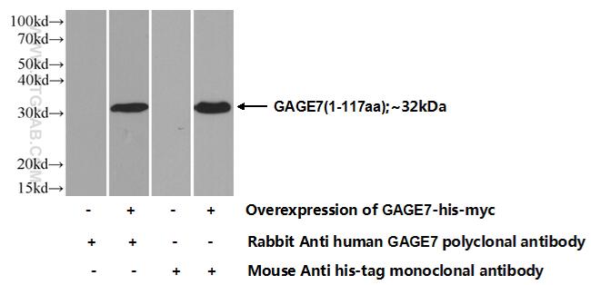 GAGE7 Antibody in Western Blot (WB)