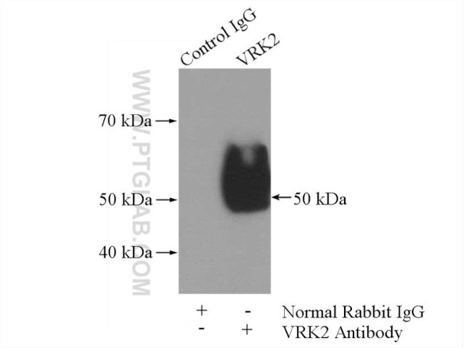 VRK2 Antibody in Immunoprecipitation (IP)