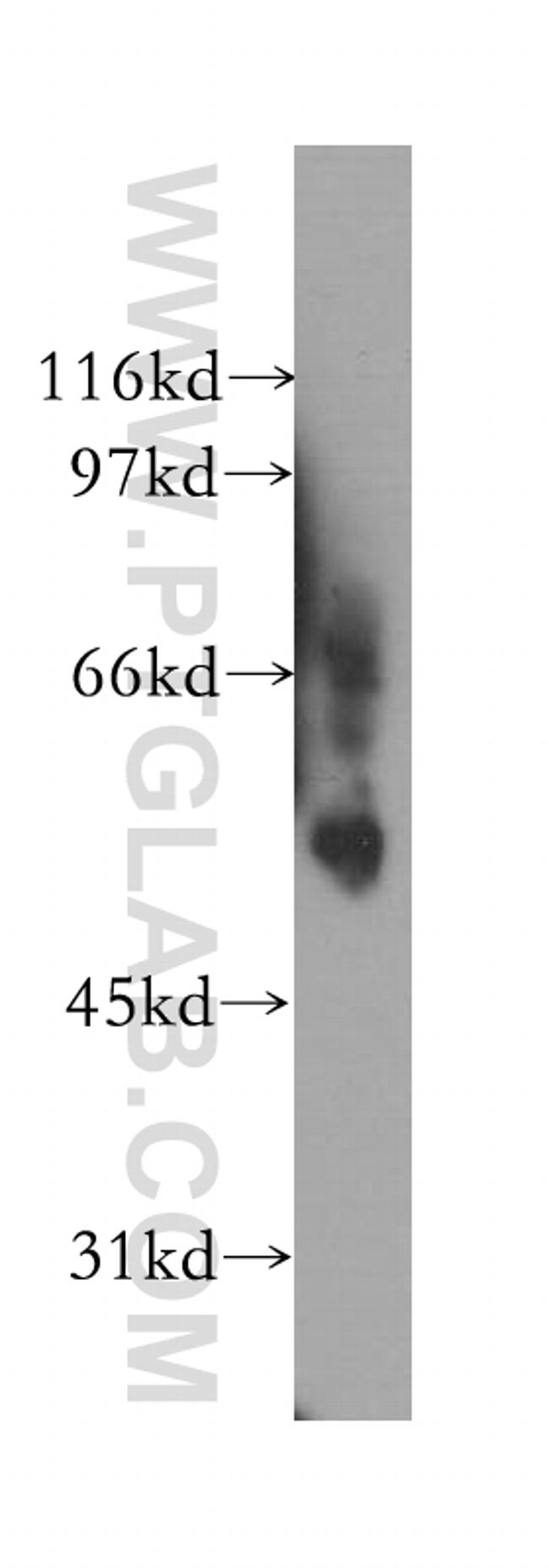 VRK2 Antibody in Western Blot (WB)