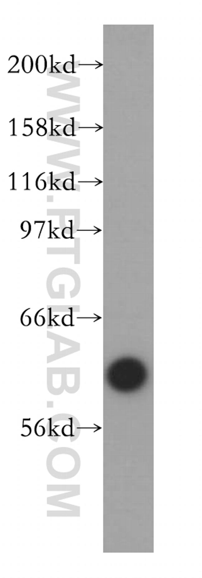 VRK2 Antibody in Western Blot (WB)
