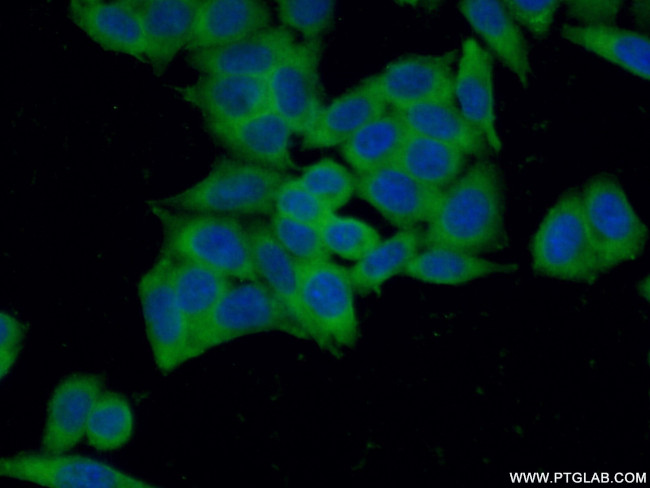 IMPDH2 Antibody in Immunocytochemistry (ICC/IF)