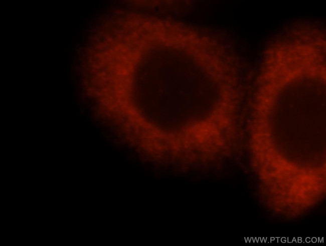 IMPDH2 Antibody in Immunocytochemistry (ICC/IF)