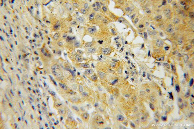 IMPDH2 Antibody in Immunohistochemistry (Paraffin) (IHC (P))