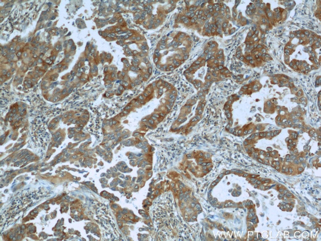 IMPDH2 Antibody in Immunohistochemistry (Paraffin) (IHC (P))