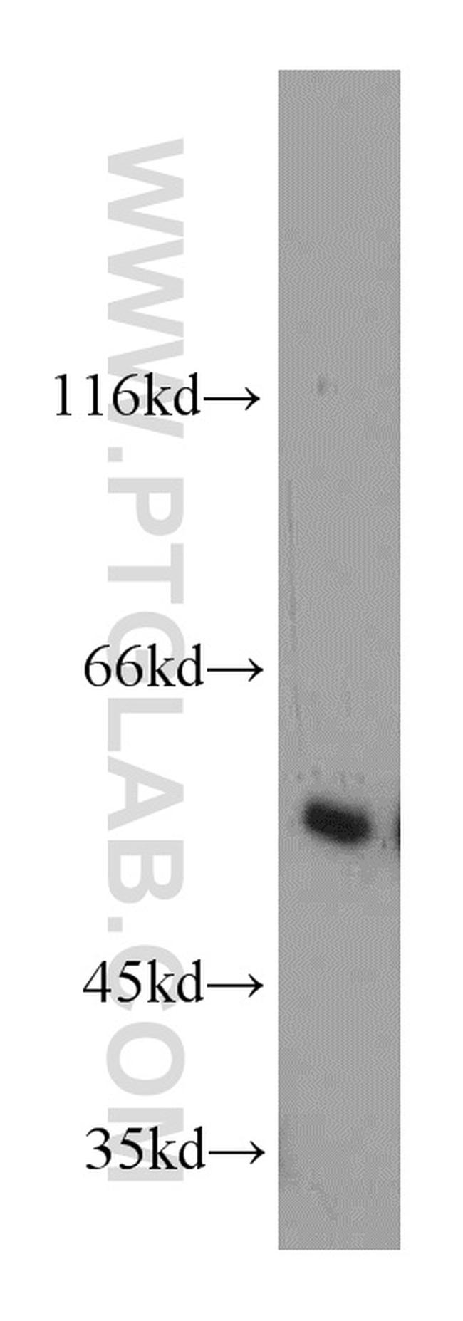 IMPDH2 Antibody in Western Blot (WB)