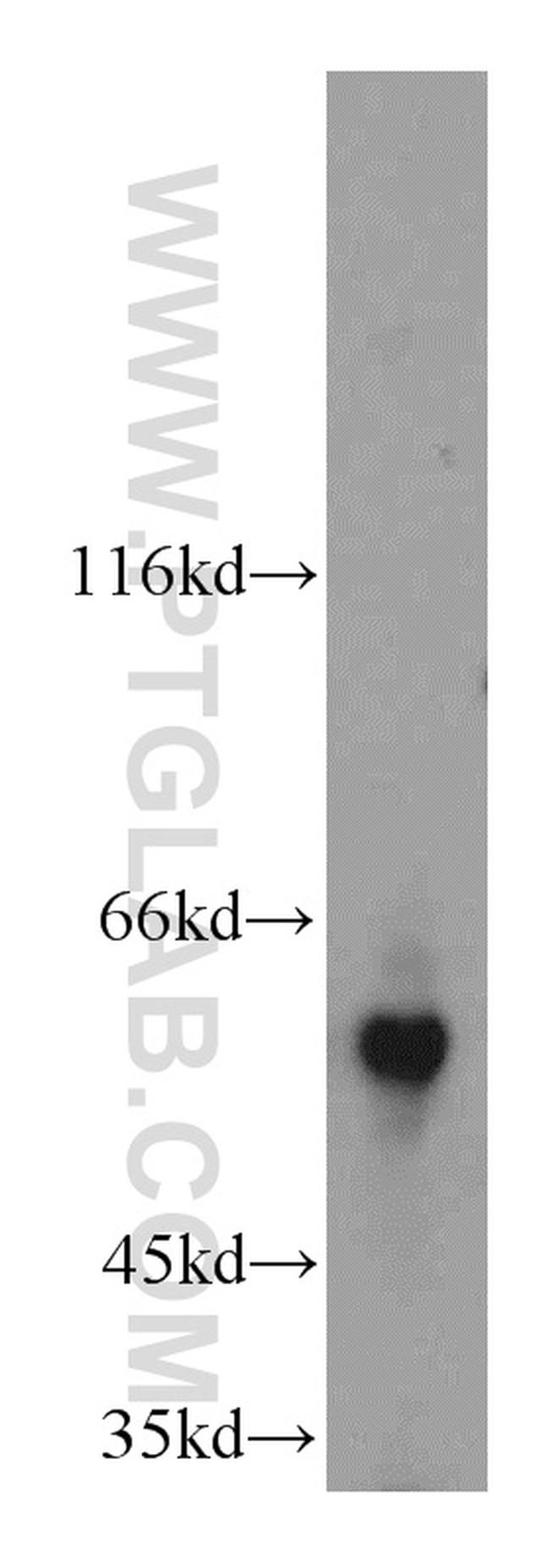 IMPDH2 Antibody in Western Blot (WB)