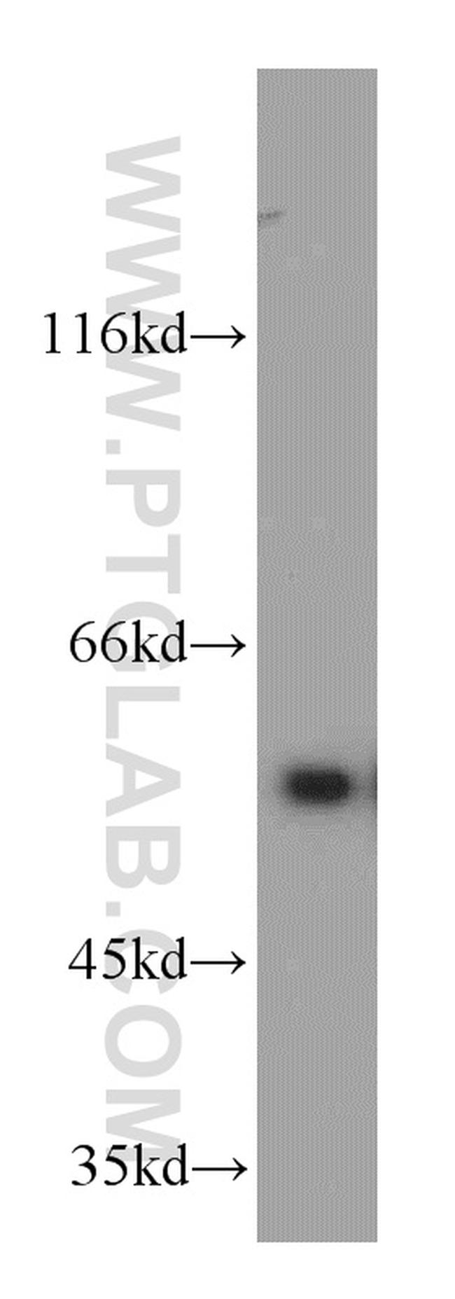 IMPDH2 Antibody in Western Blot (WB)