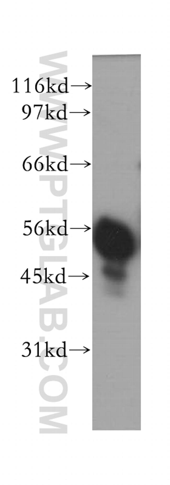 IMPDH2 Antibody in Western Blot (WB)