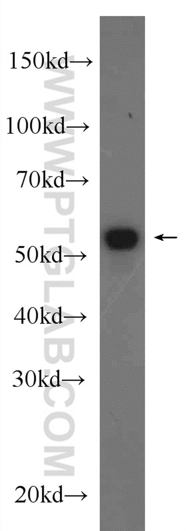 IMPDH2 Antibody in Western Blot (WB)