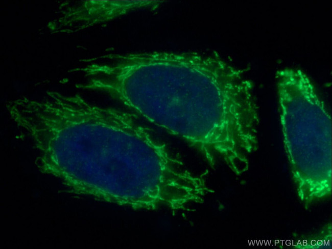 PDK4 Antibody in Immunocytochemistry (ICC/IF)