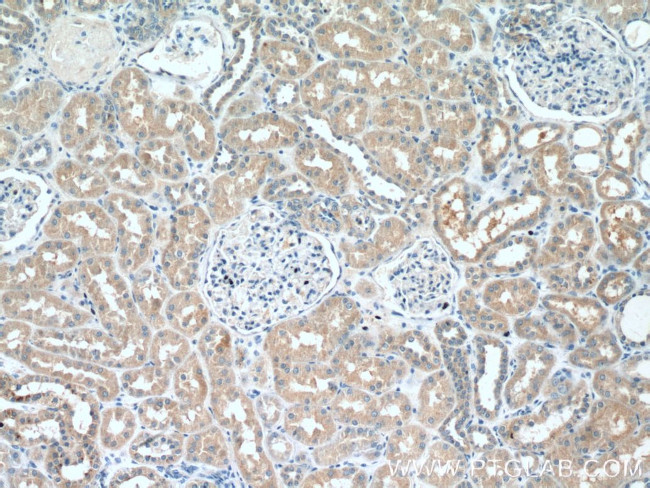 PDK4 Antibody in Immunohistochemistry (Paraffin) (IHC (P))