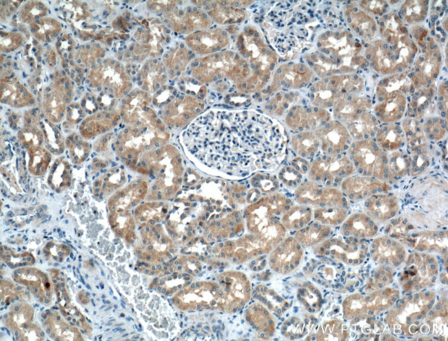 PDK4 Antibody in Immunohistochemistry (Paraffin) (IHC (P))