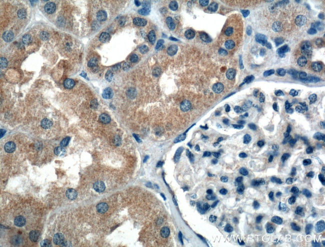 PDK4 Antibody in Immunohistochemistry (Paraffin) (IHC (P))