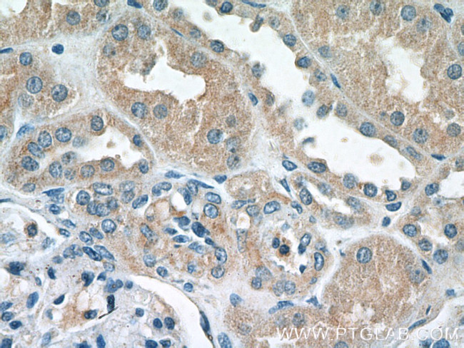 PDK4 Antibody in Immunohistochemistry (Paraffin) (IHC (P))