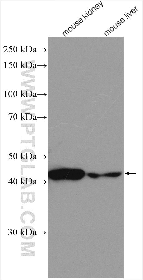 PDK4 Antibody in Western Blot (WB)