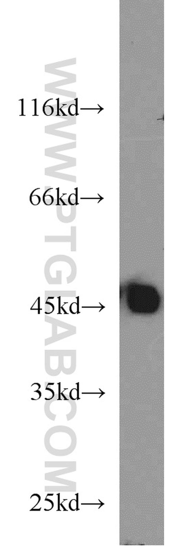 PDK4 Antibody in Western Blot (WB)