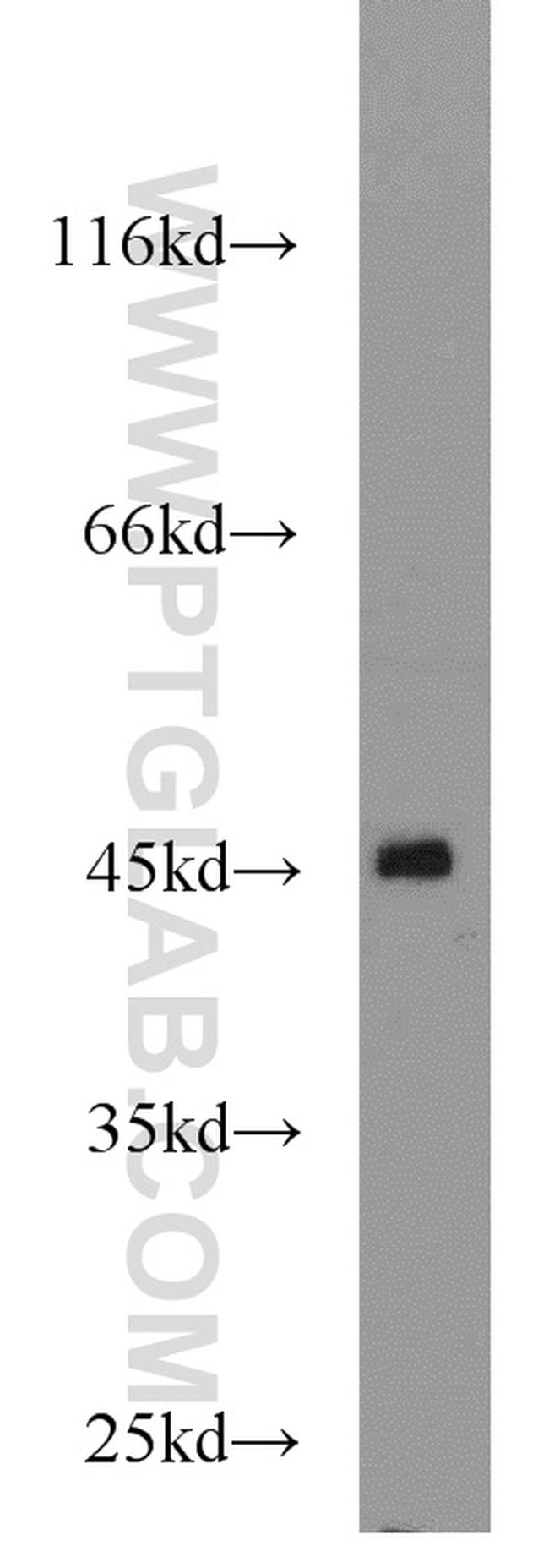 PDK4 Antibody in Western Blot (WB)