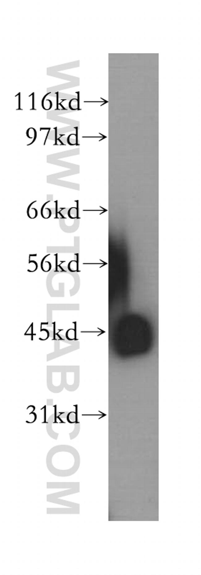 PDK4 Antibody in Western Blot (WB)