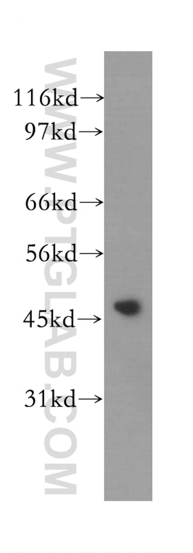 PDK4 Antibody in Western Blot (WB)