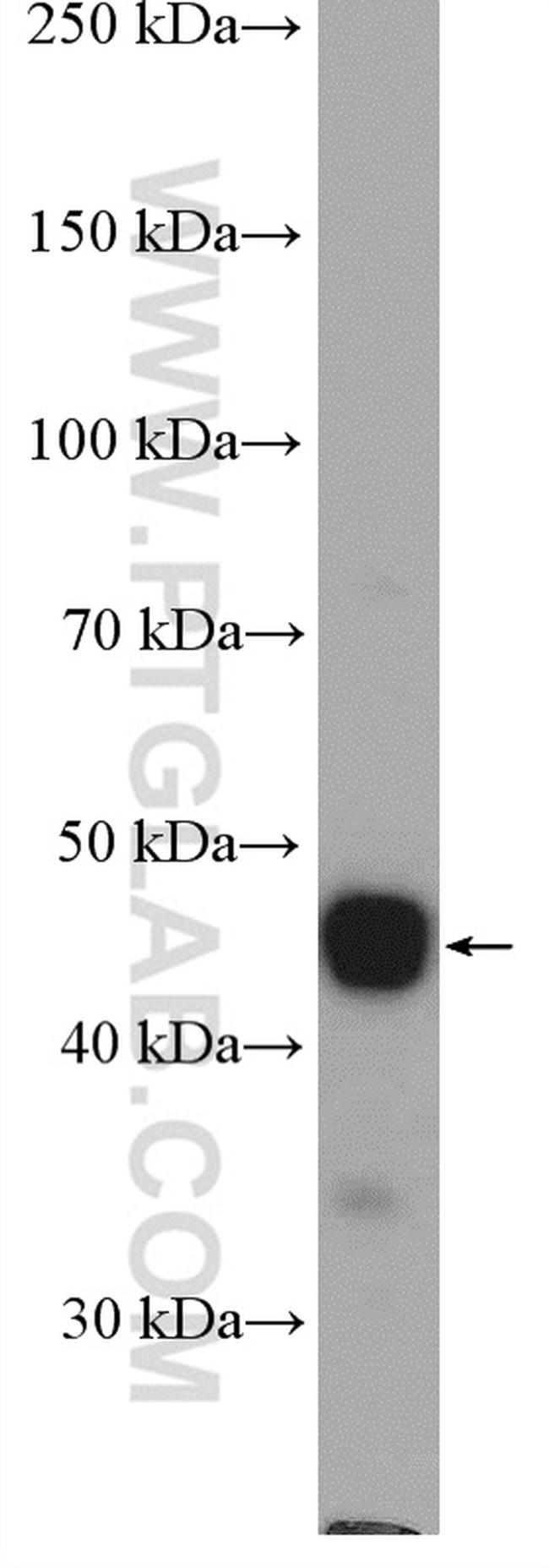 PDK4 Antibody in Western Blot (WB)