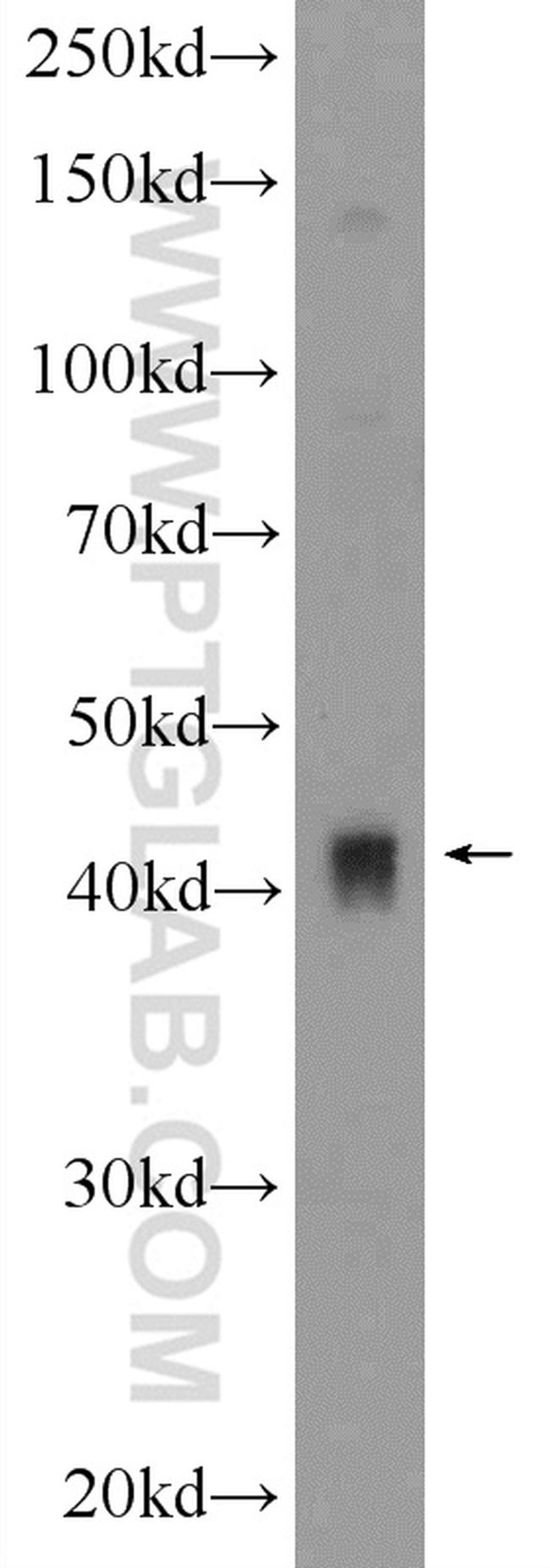 PDK4 Antibody in Western Blot (WB)