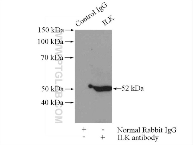 ILK Antibody in Immunoprecipitation (IP)