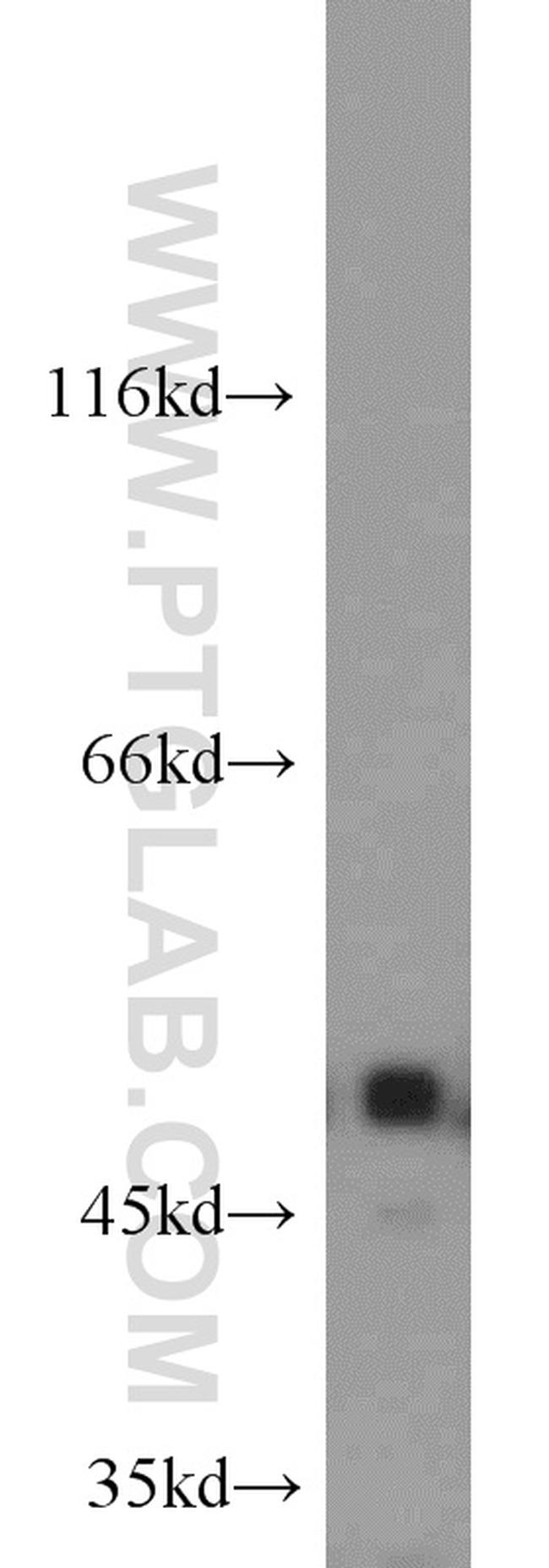 ILK Antibody in Western Blot (WB)