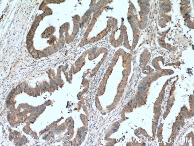 LIPA Antibody in Immunohistochemistry (Paraffin) (IHC (P))