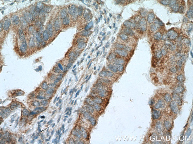 LIPA Antibody in Immunohistochemistry (Paraffin) (IHC (P))