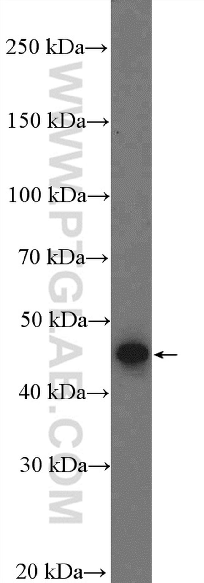 LIPA Antibody in Western Blot (WB)