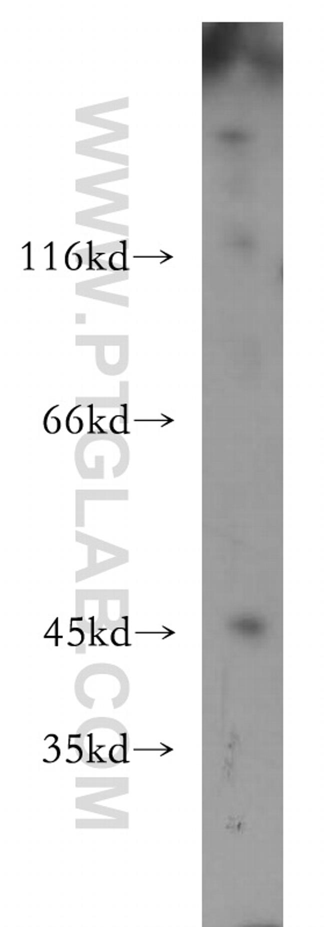 LIPA Antibody in Western Blot (WB)