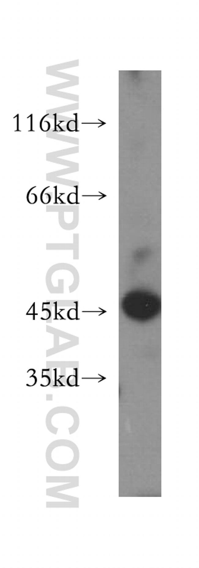 LIPA Antibody in Western Blot (WB)