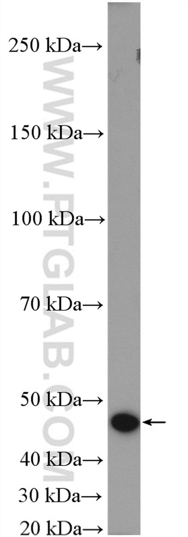 LIPA Antibody in Western Blot (WB)