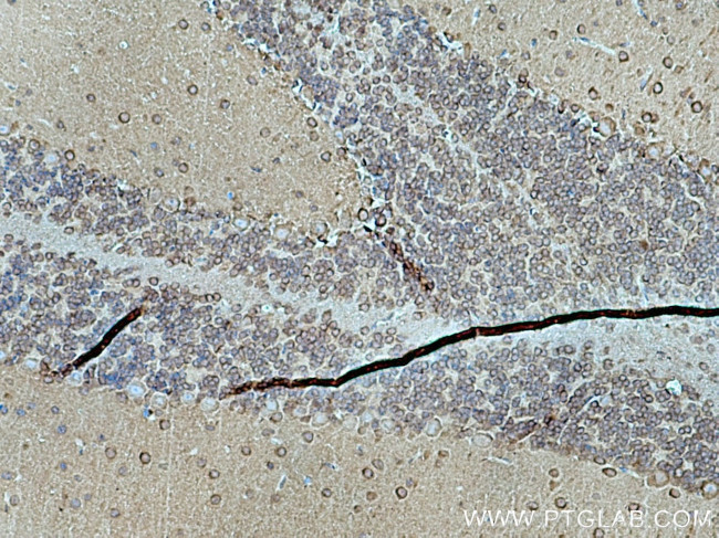 DRP1 (C-terminal) Antibody in Immunohistochemistry (Paraffin) (IHC (P))