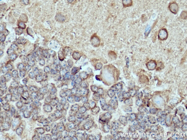 DRP1 (C-terminal) Antibody in Immunohistochemistry (Paraffin) (IHC (P))